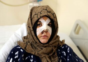 Boşanma aşamasındaki eşine vurduğu kaldırım taşı 'silah' sayıldı