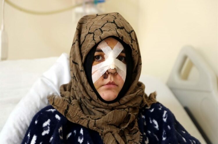 Boşanma aşamasındaki eşine vurduğu kaldırım taşı 'silah' sayıldı