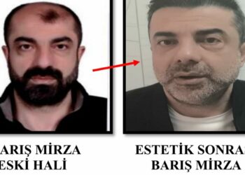 Cinayete azmettirmekten aranan şüpheli, ameliyatla yüzünü değiştirmiş