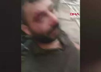 Çatıdan düşüp ağır yaralanan kaynak ustası: Ailemin tek geçim kaynağı benim, zor durumdayım