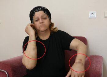 16 yıl dini nikahla birlikte yaşadığı kişi tarafından 30 yerinden bıçaklandı