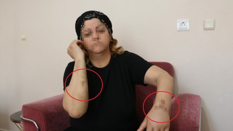 16 yıl dini nikahla birlikte yaşadığı kişi tarafından 30 yerinden bıçaklandı