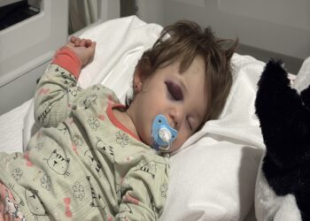 Kucağındaki bebeğiyle birlikte darbedilen baba: Odunla vurdu, kızım çırpınırken tekrar vurdu