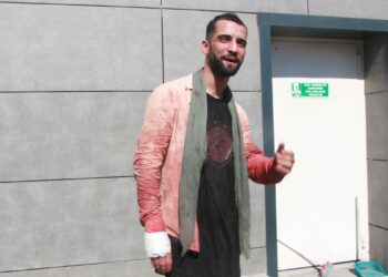 Kurban keserken bıçaklı kendini yaraladı, yaşadıklarını gülerek anlattı