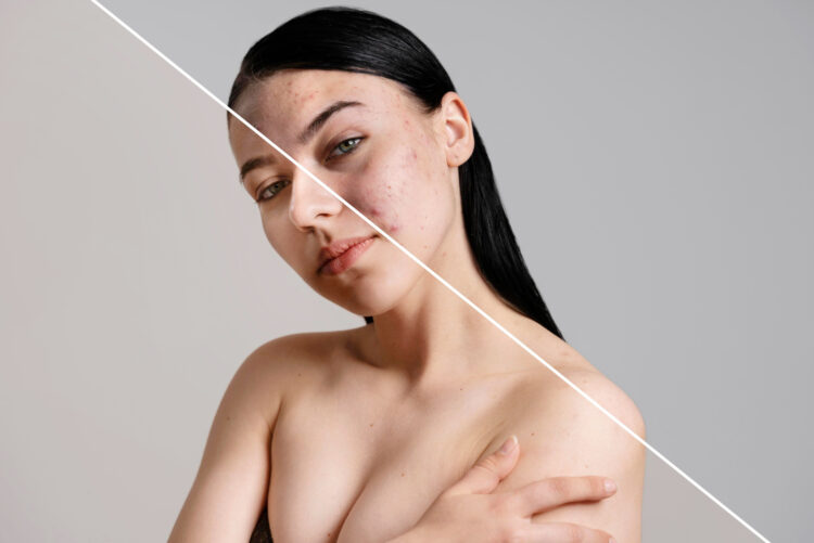 Dermapen nedir? Kaç seans yapılmalı? Cilt yenileme tedavisi hakkında merak edilenler