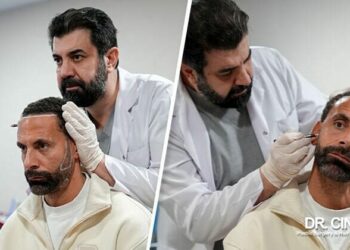 Dr. Cinik: Dünya yıldızı futbolcular saç ekimi için bizi tercih ediyor