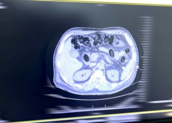 Midesinde 160 parça halinde uyuşturucuyla yakalanan yabancı uyruklu engelli, tutuklandı