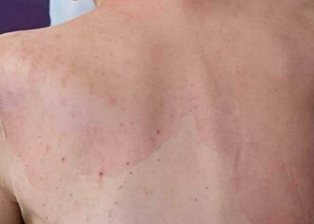 Huzurevinde ölüme verilen taksitli para cezasının gerekçesi: Gerekli tedbirler alınmamış