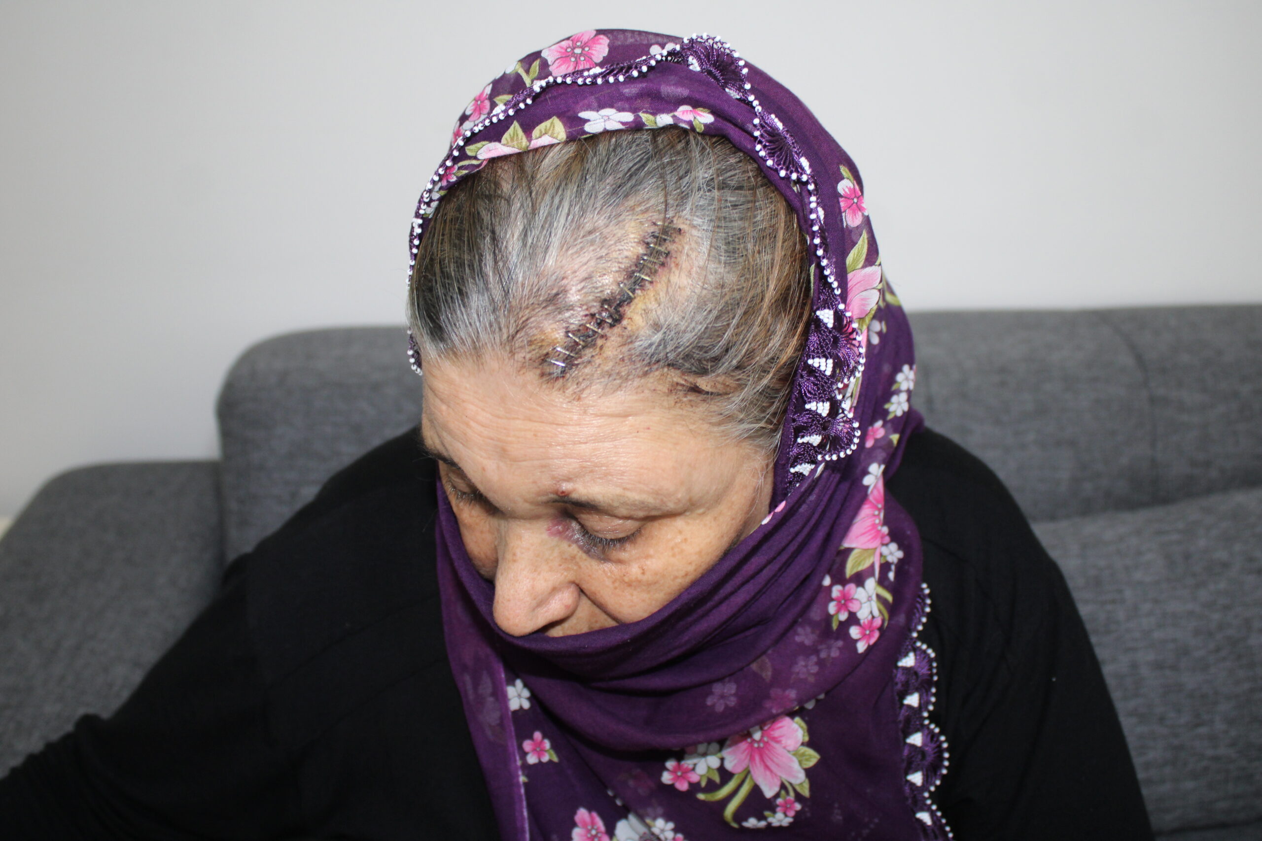 Engelli kızı için rampa isteyen kadına komşunun kürekli saldırısı kamerada; şüpheli tutuklandı