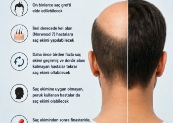 ‘Saç klonlaması, tedavide yeni bir çağın kapısını aralıyor’