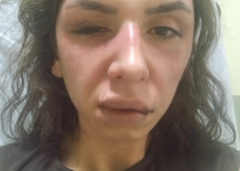 Çekmeköy'de eşini darbedip tehdit eden şüpheli tutuklandı Fotoğraf: Ceren Küp / İstanbul DHA