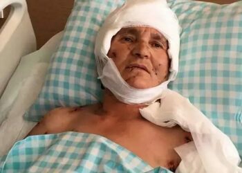 Köpek saldırısında yaralanan kadına 637 bin lira tazminat kararı