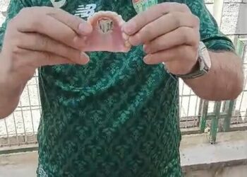 Bursaspor’un fanatik taraftarı takma dişinin damağına da kulüp amblemi yaptırdı