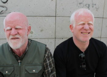 Ailesinin geçimi, babası ve kardeşi gibi kendisi de albino olan Gökhan’a emanet