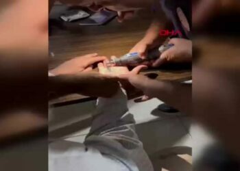 Parmaklarına sıkışan yüzükleri itfaiye çıkardı