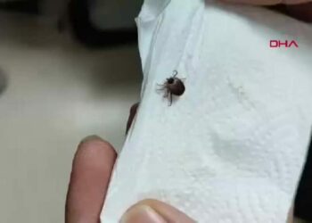 Çocuğun kulağından canlı kene çıkarıldı