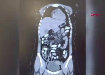Midesinde 1,5 kilo metamfetaminle yakalanan 2 kadın kurye tutuklandı