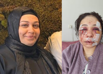 Yüzünde 60 dikişle kaldı! Eşini darbeden polis memuru 4 yıl 2 ay hapis cezasıyla tahliye edildi