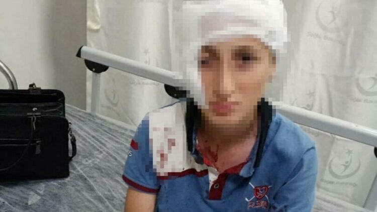 11 yaşındaki çocuğa köpek saldırısında 1,2 milyon TL tazminat kararı