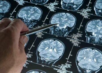 Araştırma: Derin uyku Alzheimer’ı yavaşlatıyor