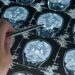 Araştırma: Derin uyku Alzheimer’ı yavaşlatıyor