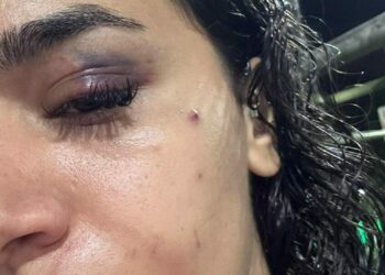 Bahçeşehir'de uzaklaştırma kararına rağmen evinin önünde darbedilen Ebru: Ölmeden önce sesimi duyun
