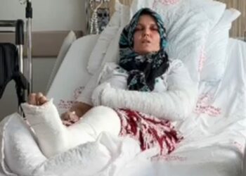 Kavgada 3 çocuk annesinin kolu ve bacağı kırıldı