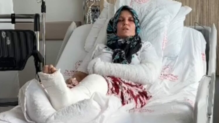 Kavgada 3 çocuk annesinin kolu ve bacağı kırıldı