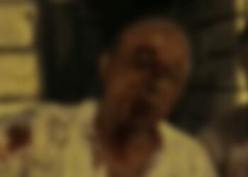 Beyoğlu’nda 'yan bakma’ kavgasında darbedilip kanlar içinde kaldı: Herşeyim patladı