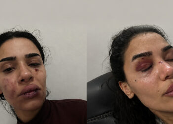Uzaklaştırma kararına rağmen evinin önünde darbedilen Ebru'dan yardım çağrısı: "Ölmeden önce sesimi duyun"