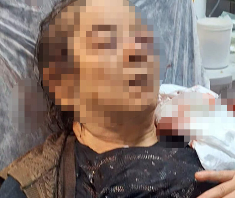 Evde otururken tavandan kopan moloz yığını altında kalan kadın yaralandı