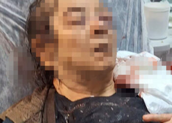 Tavandan başına sıva parçaları düşen kadının oğlu: Burnunda kırık, sol gözünde görme kaybı var