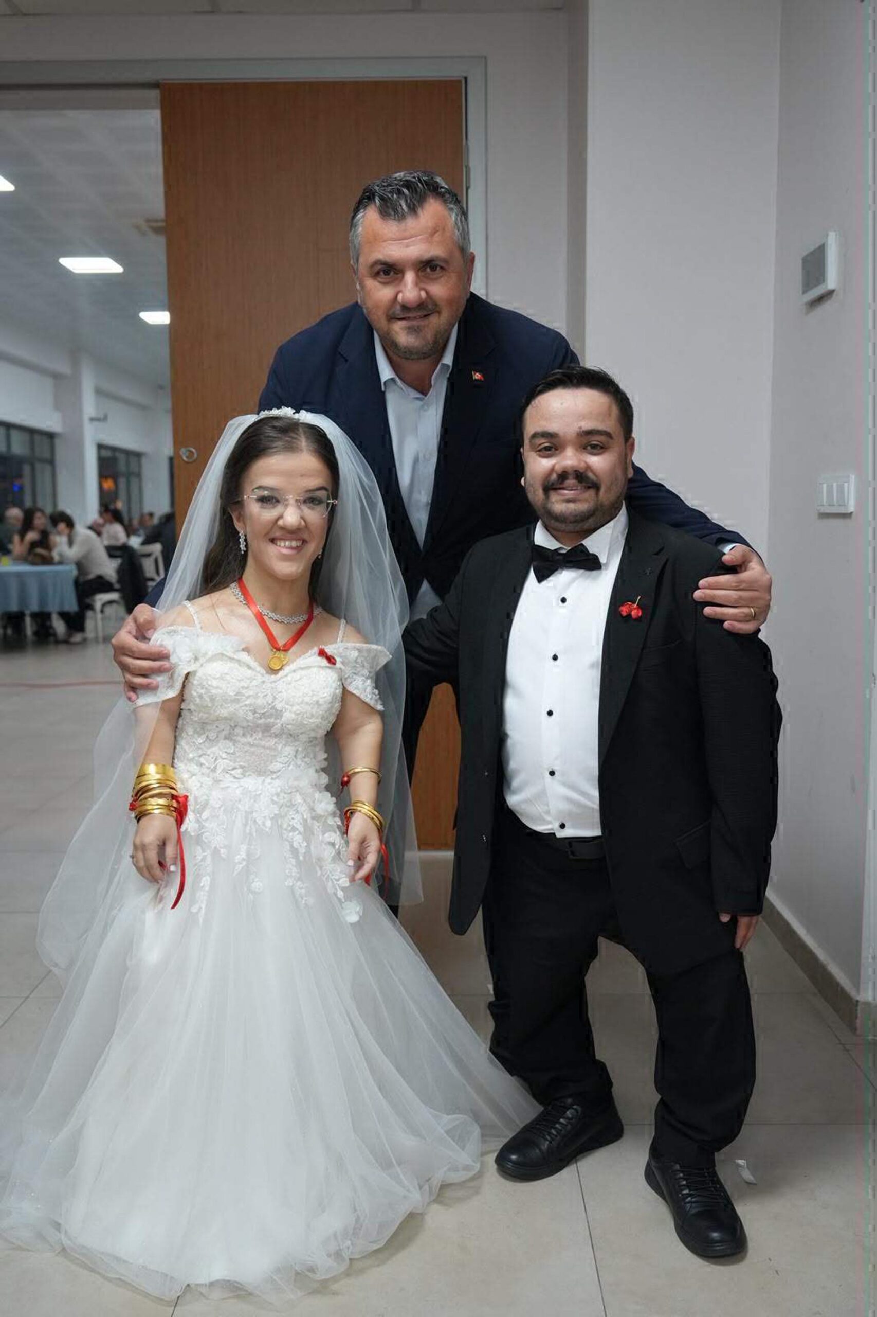 Akondroplazi hastası çift, dünyaevine girdi