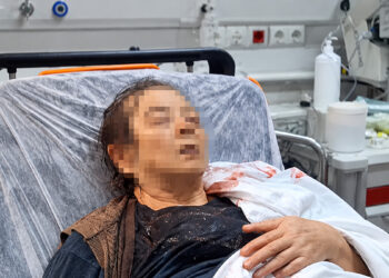Kayseri’de dairenin tavanı çöktü: Kopan molozların altında kalan yaşlı kadın yaralandı