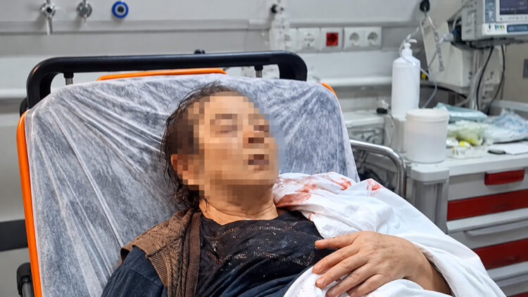 Kayseri’de dairenin tavanı çöktü: Kopan molozların altında kalan yaşlı kadın yaralandı